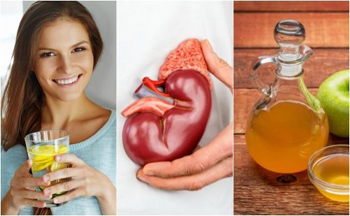6 dicas para eliminar cálculos renais