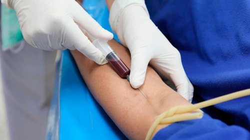 Exame de sangue