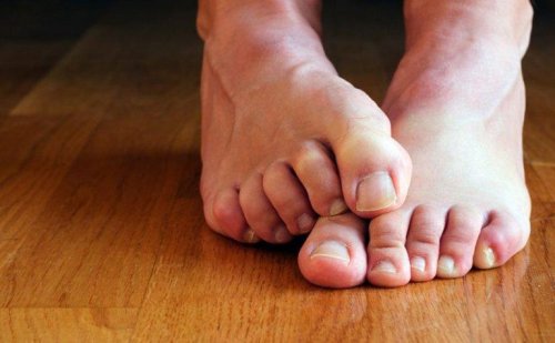Fungos nas unhas dos pés