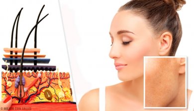 Principais causas das manchas na pele