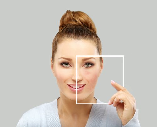 Manchas na pele do rosto