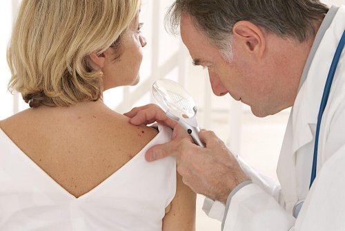 Médico fazendo check up em paciente com câncer de pele
