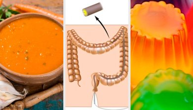 Qual a dieta e preparação antes de uma colonoscopia?