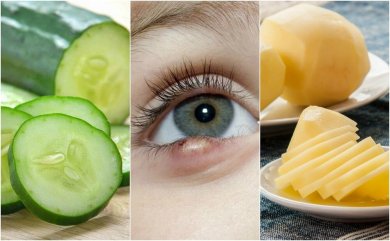 5 soluções de origem natural para curar terçol