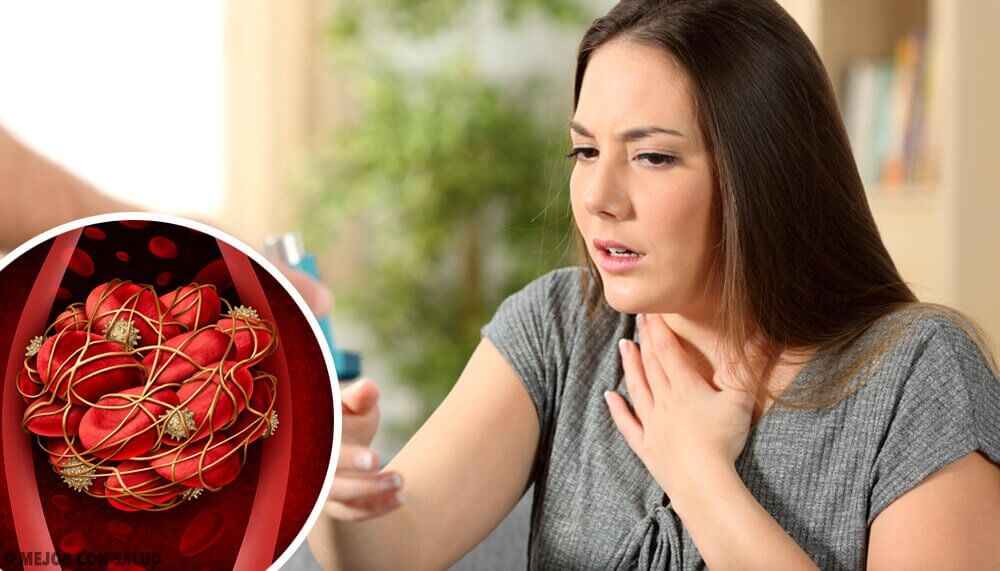 Coágulos no sangue: 8 sinais de alerta Coágulos no sangue: 8 sinais de alerta
