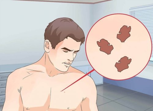 Qual é o tratamento correto para um sinal suspeito?