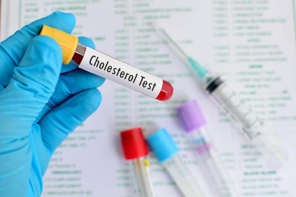Exame de sangue para medir colesterol