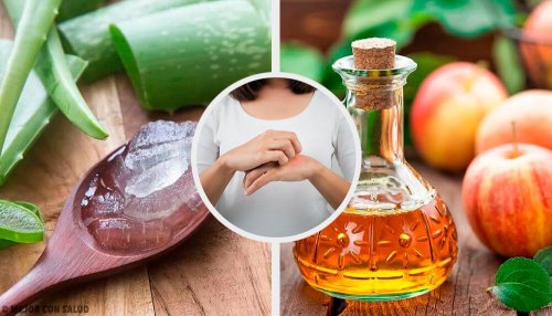 15 remédios para tratar fungos na pele