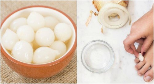 Você tem calos nos pés? Combata-os com esta solução 100% natural