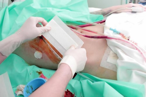 Cirurgia de transplante renal