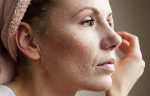 Tratamentos caseiros para a pele do rosto