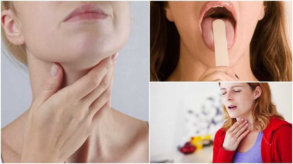 8 sintomas iniciais de câncer de garganta que você não deve ignorar