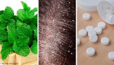 7 remédios caseiros para tratar a caspa