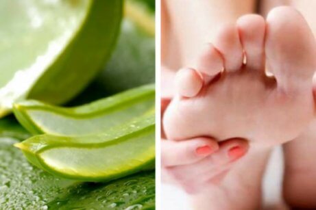 Aloe vera para o pé de atleta