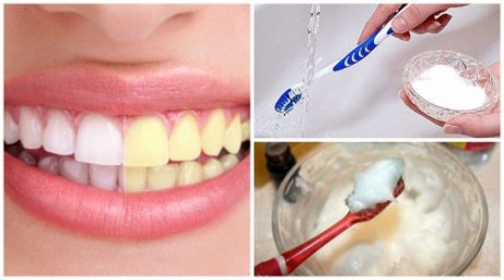 Como clarear os dentes