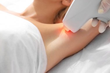 Mitos e verdades da depilação a laser
