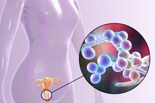 Tipos de infecções vaginais