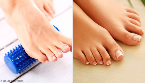 É possível eliminar os joanetes sem cirurgia?