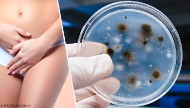 Infecções vaginais: tipos e causas