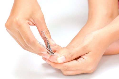 5 soluções naturais para as unhas encravadas