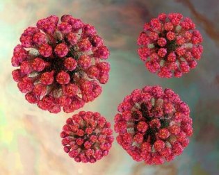 Como tratar a rubéola naturalmente?