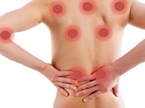 Remédios naturais para aliviar dores musculares