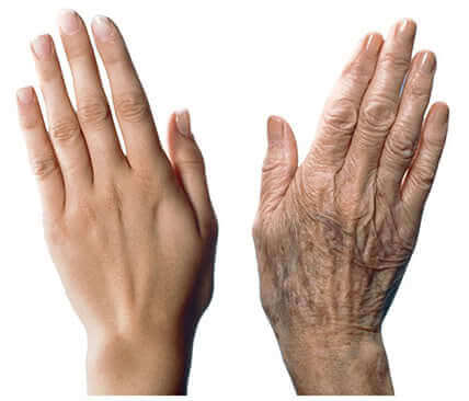 7 recomendações para cuidar das mãos e prevenir o envelhecimento