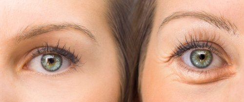 5 ingredientes naturais para firmar as pálpebras
