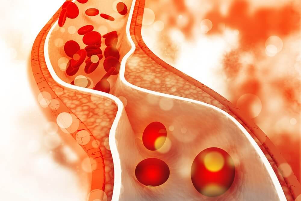 4 recomendações dietéticas para regular o colesterol 4 recomendações dietéticas para regular o colesterol