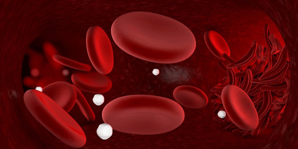 Remédios infalíveis para combater a anemia em casa Remédios infalíveis para combater a anemia em casa