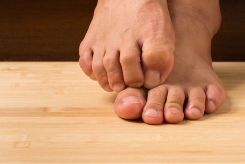 Remédios para os fungos: como curá-los com ingredientes naturais