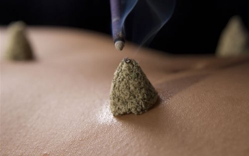 Terapia de moxabustão