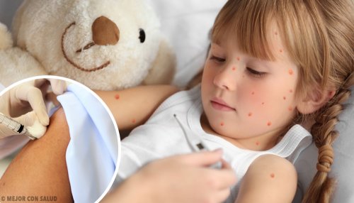 Criança com rubéola