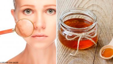 5 remédios caseiros para tratar infecções da pele