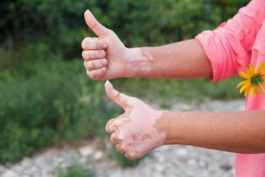 Protocolo autoimune: alimentação para doenças autoimunes