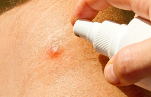 Repelente para evitar picadas de mosquito