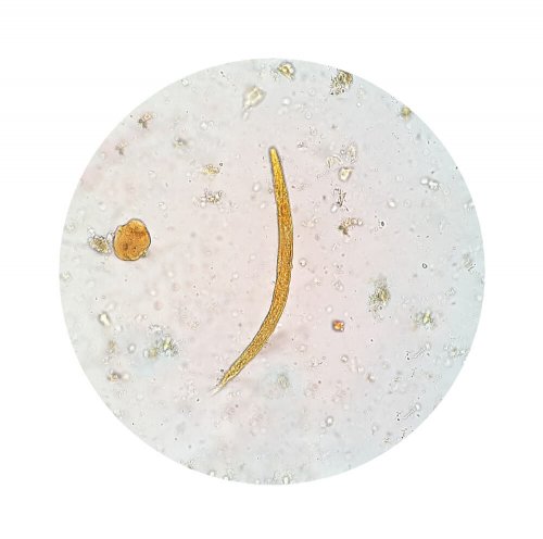 Amebíase: tratamentos naturais feitos em casa