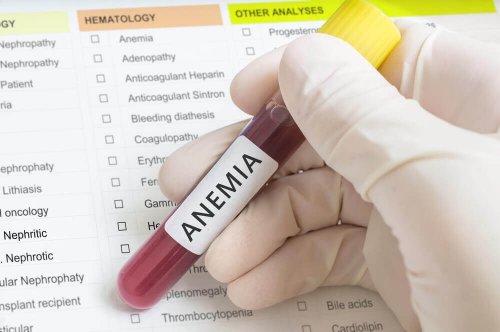 Exame para detectar anemia