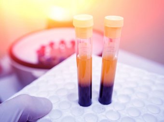 4 remédios para aumentar as plaquetas