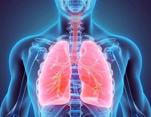 Bronquiectasia: tratamentos naturais para combatê-la