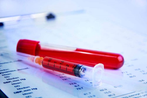 Os exames de sangue pode detectar um aborto espontâneo