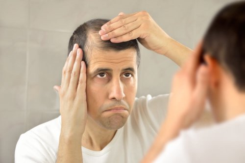Homem com começo de alopecia