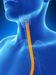 Combata aos sintomas da esofagite com 5 soluções naturais
