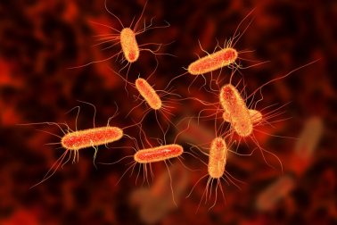 Cure a infecção intestinal com 3 remédios de origem natural