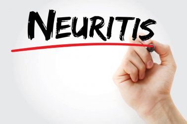 Neurite vestibular: remédios naturais para combatê-la