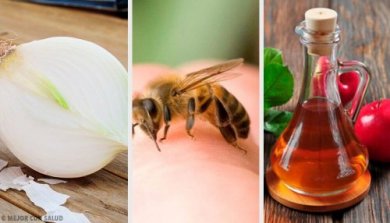 Picadas de abelha: os melhores tratamentos caseiros
