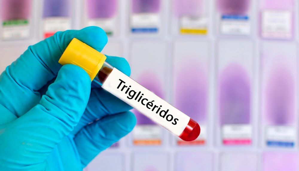 Dieta semanal para reduzir os triglicerídeos