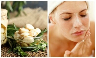5 remédios com alho para tratar a acne