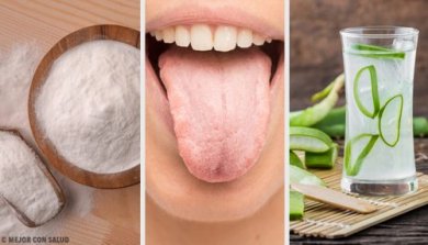 8 remédios naturais para língua branca