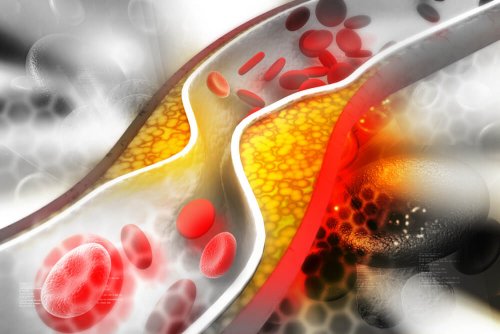 Colesterol influencia no controle da artrite